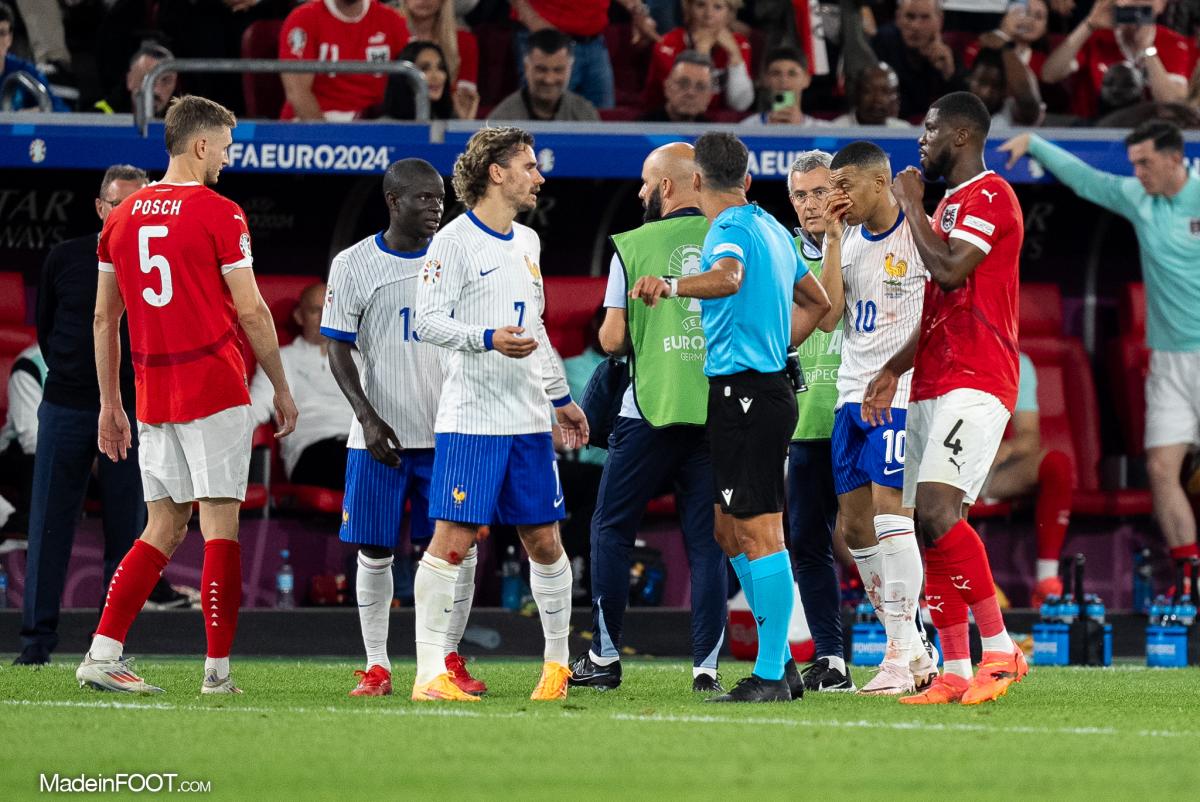 Kylian Mbappé, le ne en sang