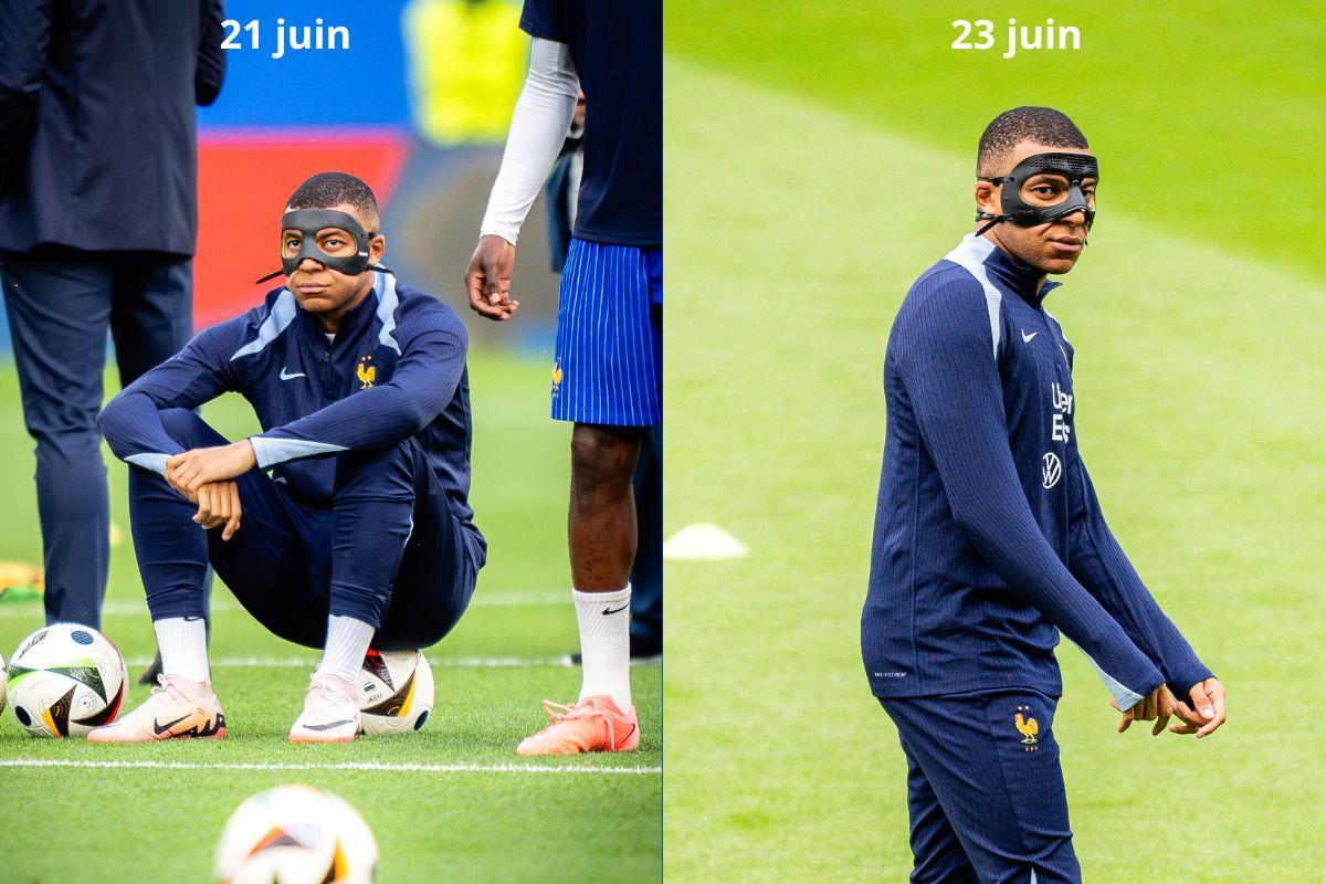 Kylian Mbappé et son nouveau masque.